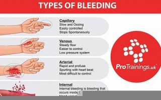 bleed中文翻译,bleed发音,bleed用法及例句,bleed是什么意思