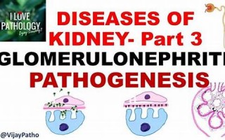 nephritis什么意思,nephritis中文翻译,nephritis用法及例句,nephritis怎么读