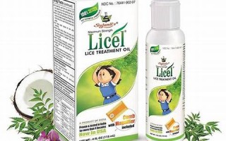 lice什么意思,lice中文翻译,lice用法及例句,lice怎么读