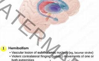 lesion什么意思,lesion中文翻译,lesion用法及例句,lesion怎么读