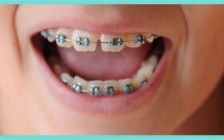 orthodontics什么意思,orthodontics中文翻译,orthodontics用法及例句,orthodontics怎么读